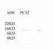 Anti-Cytochrome C antibody used in Western Blot (WB). GTX78200