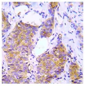 Anti-CRK antibody used in IHC (Paraffin sections) (IHC-P). GTX78919