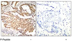 Anti-MEF2A (phospho Ser408) antibody used in IHC (Paraffin sections) (IHC-P). GTX79018