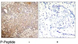 Anti-Cytokeratin 18 (phospho Ser33) antibody used in IHC (Paraffin sections) (IHC-P). GTX79025