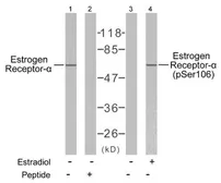 Anti-Estrogen Receptor alpha (phospho Ser106) antibody used in Western Blot (WB). GTX79082
