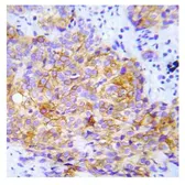 Anti-CrkL (phospho Tyr207) antibody used in IHC (Paraffin sections) (IHC-P). GTX79096