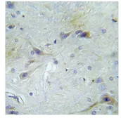 Anti-APP (phospho Thr743/Thr668) antibody used in IHC (Paraffin sections) (IHC-P). GTX79123