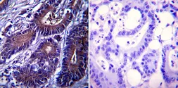 Anti-Heat Shock Protein 104 antibody [Antiserum 8-1] used in IHC (Paraffin sections) (IHC-P). GTX79159