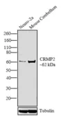 Anti-CRMP2 antibody used in Western Blot (WB). GTX79170