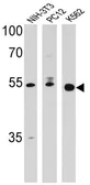 Anti-PPAR delta antibody used in Western Blot (WB). GTX79186
