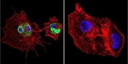 Anti-Cyclophilin 40 antibody used in Immunocytochemistry/ Immunofluorescence (ICC/IF). GTX79245