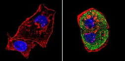 Anti-SREBP1 antibody used in Immunocytochemistry/ Immunofluorescence (ICC/IF). GTX79299