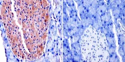 Anti-TIMP2 antibody [F27 P3 A4] used in IHC (Paraffin sections) (IHC-P). GTX79355