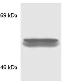 Anti-FKBP4 antibody used in Western Blot (WB). GTX79366