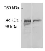 Anti-ADAMTS9 antibody used in Western Blot (WB). GTX79416