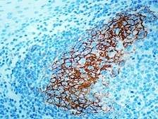 Anti-CD23 antibody [SP23] (ready-to-use) used in IHC (Paraffin sections) (IHC-P). GTX79430