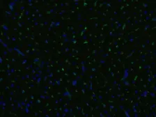 Anti-CD105 antibody [MEM-229] (PE) used in Immunocytochemistry/ Immunofluorescence (ICC/IF). GTX79975