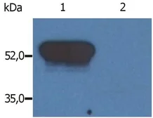 Anti-GFAP antibody [GF-02] used in Western Blot (WB). GTX80148