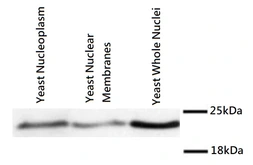 Anti-Mad2 antibody used in Western Blot (WB). GTX80373
