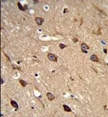 Anti-ASIC1 antibody, C-term used in IHC (Paraffin sections) (IHC-P). GTX80451