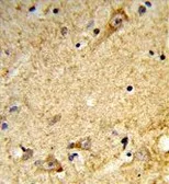 Anti-MARVELD2 antibody, C-term used in IHC (Paraffin sections) (IHC-P). GTX80484