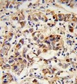 Anti-SPRR1B antibody, C-term used in IHC (Paraffin sections) (IHC-P). GTX80592