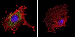 Anti-Dynein antibody [74.1] used in Immunocytochemistry/ Immunofluorescence (ICC/IF). GTX80684