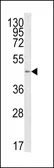 Anti-B4GALT1 antibody, C-term used in Western Blot (WB). GTX80958