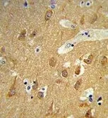 Anti-TSPAN12 antibody, C-term used in IHC (Paraffin sections) (IHC-P). GTX81087