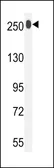 Anti-LTBP1 antibody, C-term used in Western Blot (WB). GTX81296