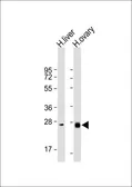 Anti-Neurotrophin 3 antibody, C-term used in Western Blot (WB). GTX81308