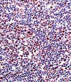 Anti-RUNX2 antibody used in IHC (Paraffin sections) (IHC-P). GTX81326
