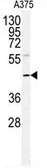 Anti-POLDIP2 antibody, Internal used in Western Blot (WB). GTX81346