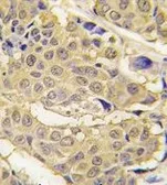 Anti-EPRS antibody, N-term used in IHC (Paraffin sections) (IHC-P). GTX81390