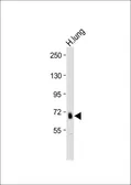 Anti-ADAMTS4 antibody, C-term used in Western Blot (WB). GTX81446