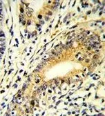 Anti-FAM3B antibody, N-term used in IHC (Paraffin sections) (IHC-P). GTX81667