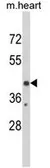 Anti-EGR3 antibody, Internal used in Western Blot (WB). GTX81724