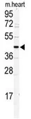Anti-DCC1 antibody, N-term used in Western Blot (WB). GTX81965