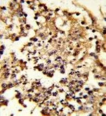 Anti-HSP105 antibody, Internal used in IHC (Paraffin sections) (IHC-P). GTX81974