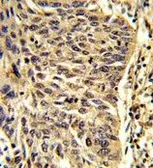 Anti-SNRPD1 antibody, Internal used in IHC (Paraffin sections) (IHC-P). GTX81985