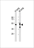 Anti-RAGE antibody, N-term used in Western Blot (WB). GTX82505