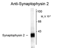 Anti-SYNPR antibody used in Western Blot (WB). GTX82586