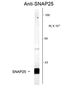 Anti-SNAP25 antibody used in Western Blot (WB). GTX82597
