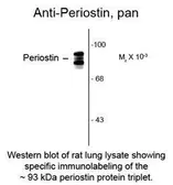 Anti-Periostin antibody used in  (). GTX82615