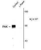 Anti-PAK1 ( phospho Thr423 ) / PAK2 ( phospho Thr402 ) / PAK3 ( phospho Thr436 ) antibody used in Western Blot (WB). GTX82619