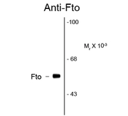 Anti-FTO antibody [5-2H10] used in Western Blot (WB). GTX82693