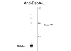 Anti-Glutathione S-transferase kappa 1 antibody used in Western Blot (WB). GTX82705