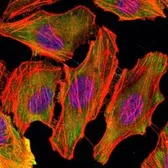 Anti-CSK antibody [5F3] used in Immunocytochemistry/ Immunofluorescence (ICC/IF). GTX82757