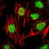 Anti-PLZF antibody [5B3] used in Immunocytochemistry/ Immunofluorescence (ICC/IF). GTX82804