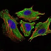 Anti-STAT6 antibody [7D3] used in Immunocytochemistry/ Immunofluorescence (ICC/IF). GTX82814