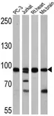 Anti-FOXO3A antibody used in Western Blot (WB). GTX82877