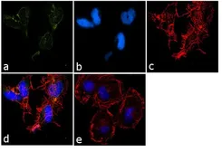 Anti-HCN2 antibody used in Immunocytochemistry/ Immunofluorescence (ICC/IF). GTX82890