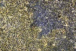 Anti-IL21 antibody used in Immunohistochemistry (IHC). GTX82914