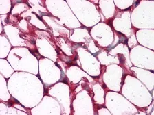 Anti-ETS1 antibody [8A8] used in IHC (Paraffin sections) (IHC-P). GTX83003